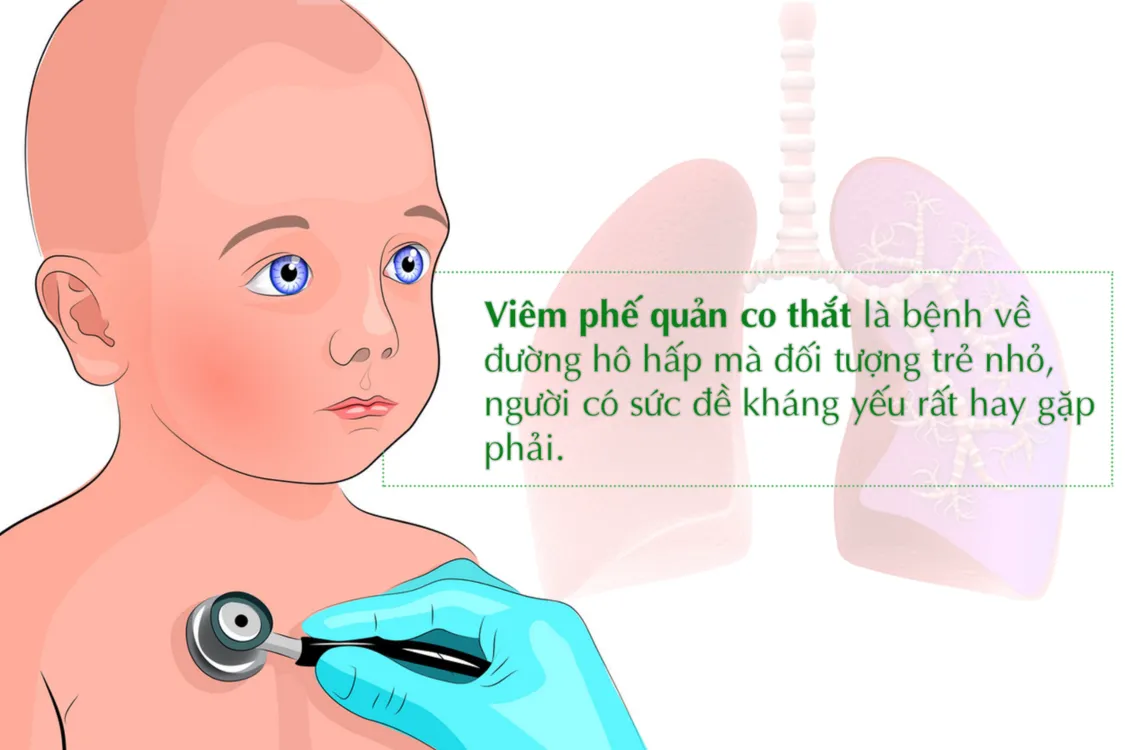 Viêm phế quản co thắt là một bệnh đường hô hấp thường gặp ở trẻ nhỏ